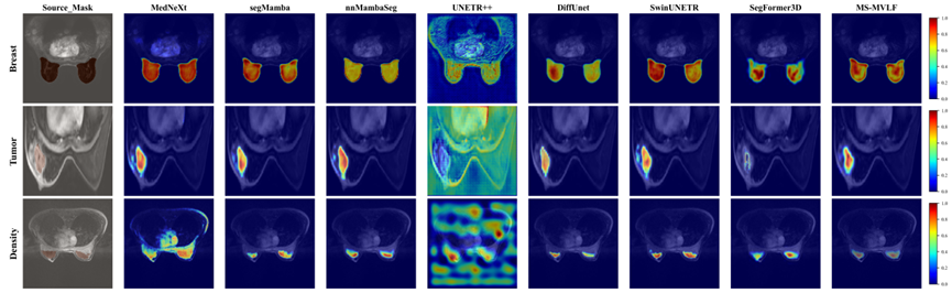 segmentation visualization